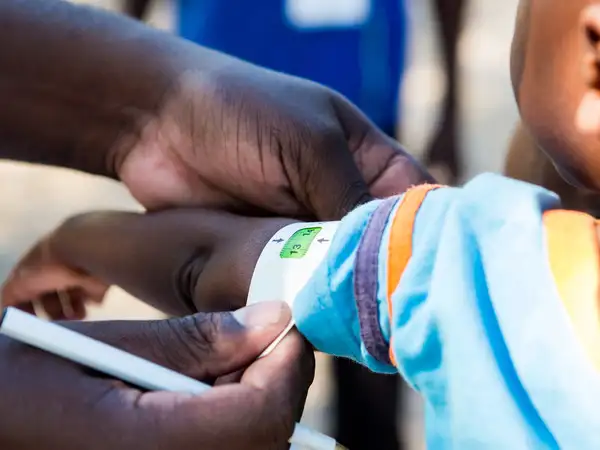 Africa - Zimbabwe - Baby's arm measured